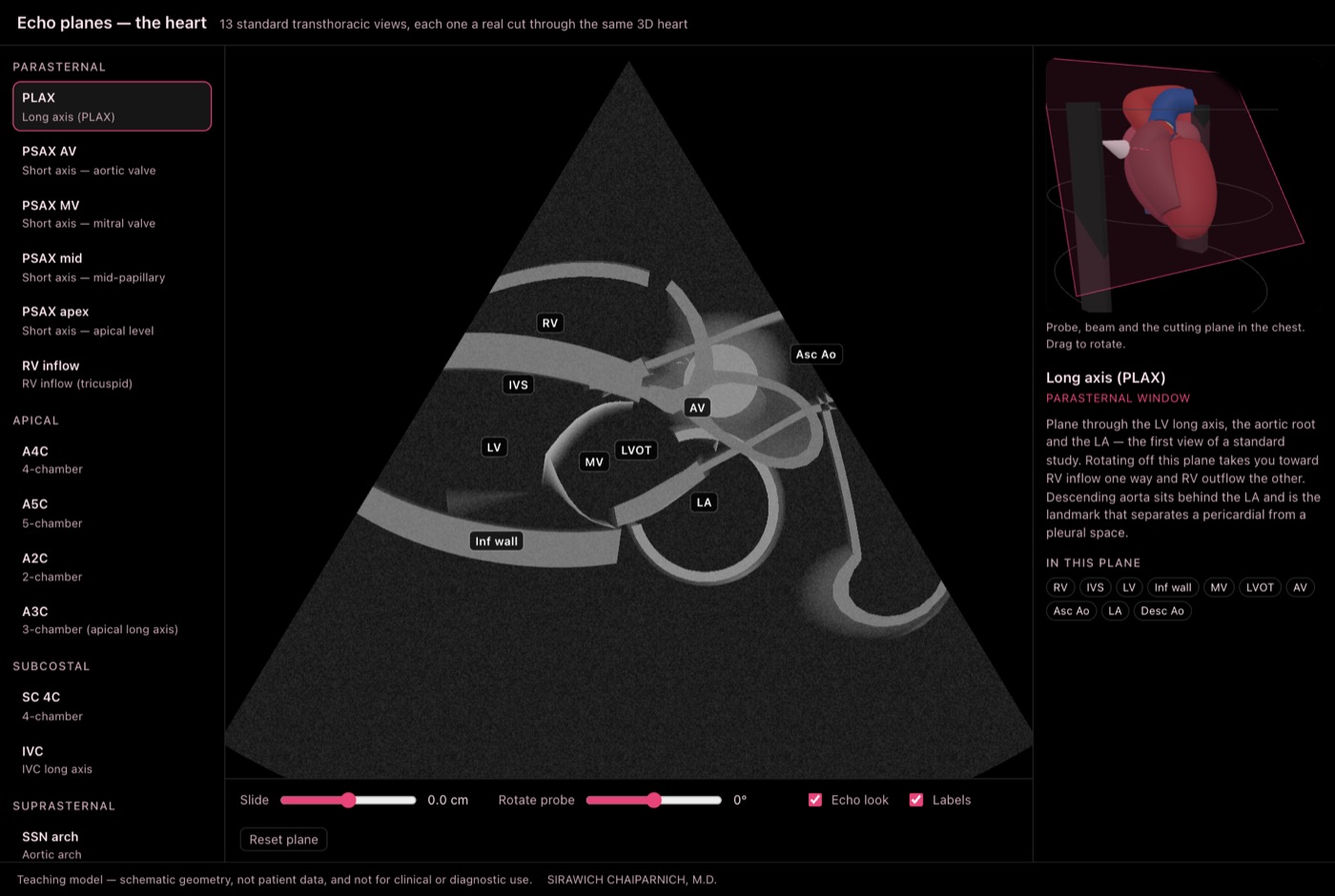 Echo Planes Explorer showing the parasternal long axis view