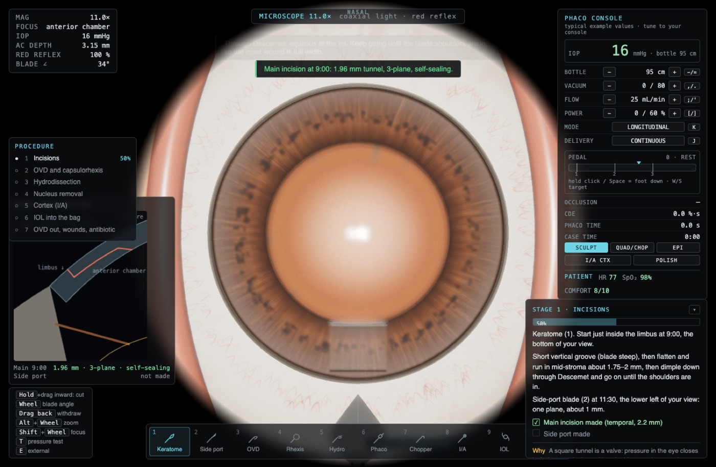 Phacoemulsification simulator